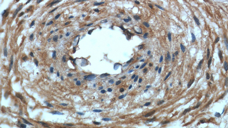 Immunohistochemical of paraffin-embedded human placenta using Catalog No:107045(CD146, MCAM antibody) at dilution of 1:200 (under 40x lens)