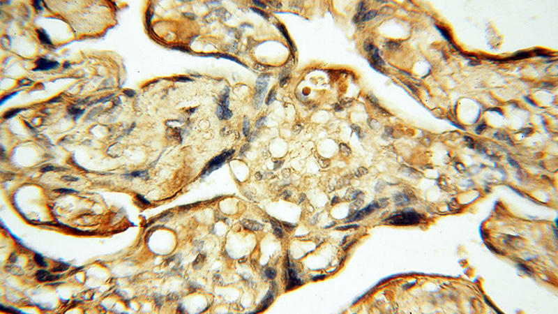Immunohistochemical of paraffin-embedded human placenta using Catalog No:109295(CHST14 antibody) at dilution of 1:50 (under 40x lens)