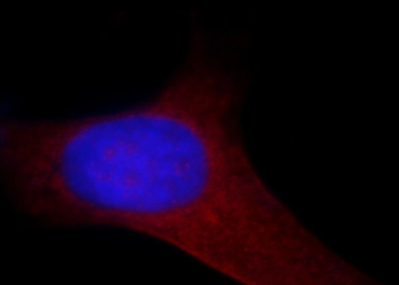 Immunofluorescent analysis of Hela cells, using SGSM3 antibody Catalog No:115175 at 1:25 dilution and Rhodamine-labeled goat anti-rabbit IgG (red). Blue pseudocolor = DAPI (fluorescent DNA dye).