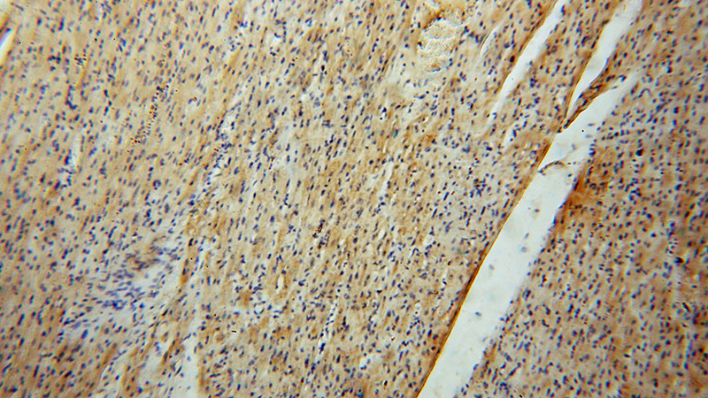 Immunohistochemical of paraffin-embedded human heart using Catalog No:115746(SURF1 antibody) at dilution of 1:50 (under 10x lens)