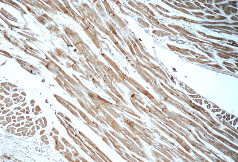 Immunohistochemistry of paraffin-embedded human heart tissue slide using Catalog No:113025(N-cadherin Antibody) at dilution of 1:50 (under 10x lens)