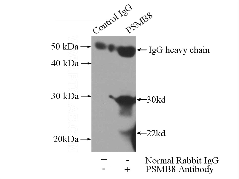 IP Result of anti-PSMB8 (IP:Catalog No:112287, 3ug; Detection:Catalog No:112287 1:1000) with Raji cells lysate 2800ug.