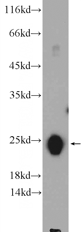 mouse skeletal muscle tissue were subjected to SDS PAGE followed by western blot with Catalog No:116153(TNNI2 Antibody) at dilution of 1:1000