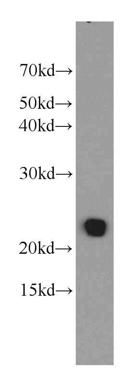 mouse lung tissue were subjected to SDS PAGE followed by western blot with Catalog No:116098(TMEM139 antibody) at dilution of 1:800