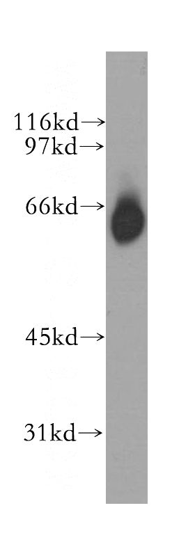 mouse skeletal muscle tissue were subjected to SDS PAGE followed by western blot with Catalog No:110809(GABRA4 antibody) at dilution of 1:500