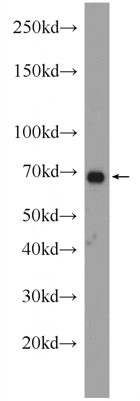 L02 cells were subjected to SDS PAGE followed by western blot with Catalog No:113686(PCCA antibody) at dilution of 1:1000