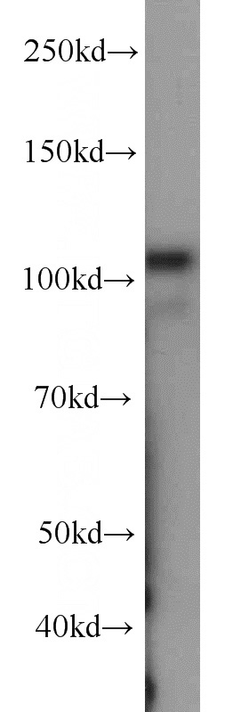 HepG2 cells were subjected to SDS PAGE followed by western blot with Catalog No:107532(USP1 antibody) at dilution of 1:1000