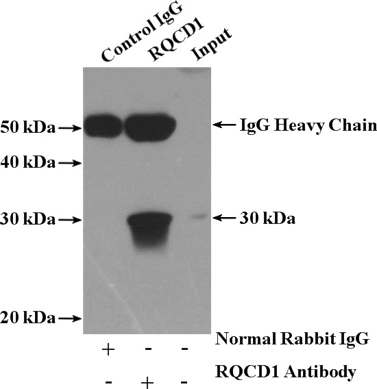 IP Result of anti-RQCD1 (IP:Catalog No:114918, 4ug; Detection:Catalog No:114918 1:1000) with MCF-7 cells lysate 1280ug.