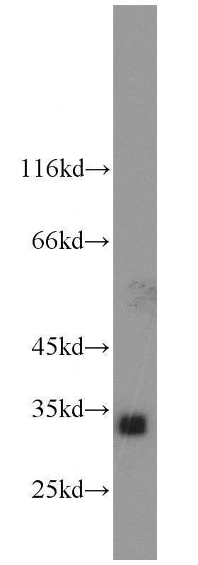 HepG2 cells were subjected to SDS PAGE followed by western blot with Catalog No:107941(AKR1C3 antibody) at dilution of 1:1000