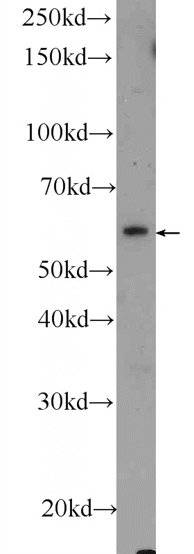 rat brain tissue were subjected to SDS PAGE followed by western blot with Catalog No:111995(KIAA1598 Antibody) at dilution of 1:600