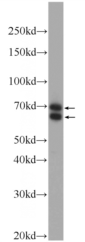 mouse brain tissue were subjected to SDS PAGE followed by western blot with Catalog No:108367(BBS1 Antibody) at dilution of 1:600
