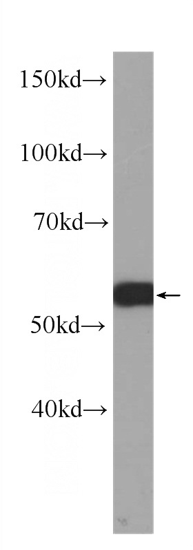 CHO cells were subjected to SDS PAGE followed by western blot with Catalog No:107180(c-SRC Antibody) at dilution of 1:1000
