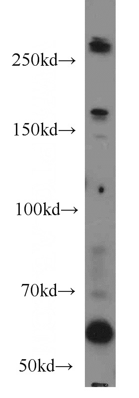 HEK-293 cells were subjected to SDS PAGE followed by western blot with Catalog No:109179(CEP290 antibody) at dilution of 1:500