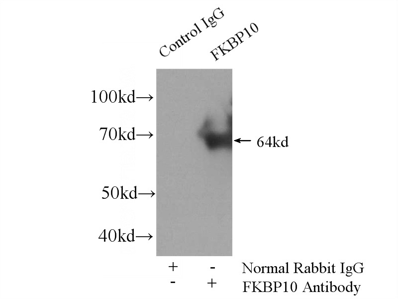 IP Result of anti-FKBP10 (IP:Catalog No:110669, 4ug; Detection:Catalog No:110669 1:600) with HEK-293 cells lysate 2800ug.