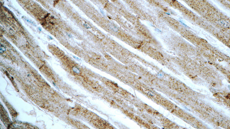 Immunohistochemistry of paraffin-embedded human heart tissue slide using Catalog No:113025(N-cadherin Antibody) at dilution of 1:50 (under 40x lens)