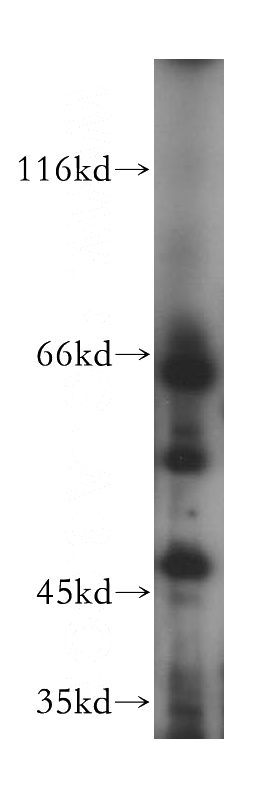 Jurkat cells were subjected to SDS PAGE followed by western blot with Catalog No:111975(KCNN1 antibody) at dilution of 1:600