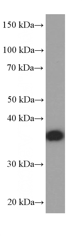 Neuro-2a cells were subjected to SDS PAGE followed by western blot with Catalog No:107471(PHOX2B Antibody) at dilution of 1:2500