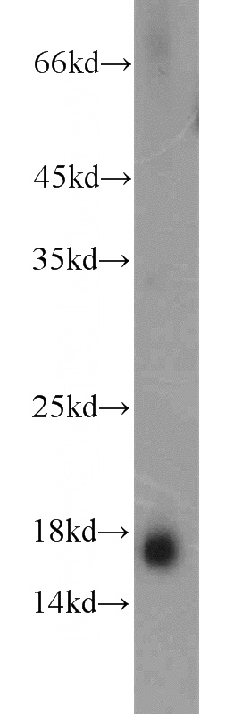 human blood tissue were subjected to SDS PAGE followed by western blot with Catalog No:114179(TTR antibody) at dilution of 1:1000