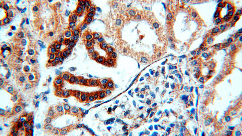 Immunohistochemical of paraffin-embedded human kidney using Catalog No:107780(ADCY3 antibody) at dilution of 1:100 (under 40x lens)