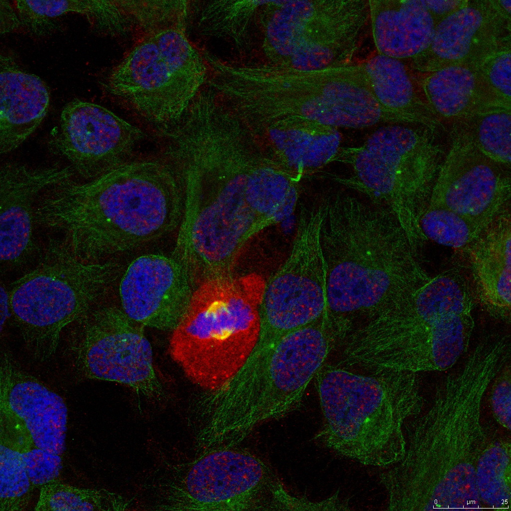 Immunofluorescence staining of methanol-fixed Hela using NFκB-p65(Phospho-Thr254) Antibody .