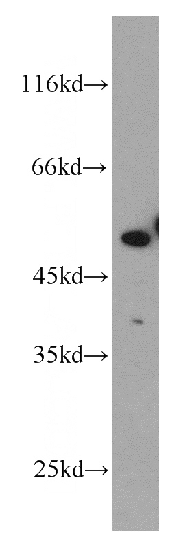 Jurkat cells were subjected to SDS PAGE followed by western blot with Catalog No:115976(TADA3L antibody) at dilution of 1:300