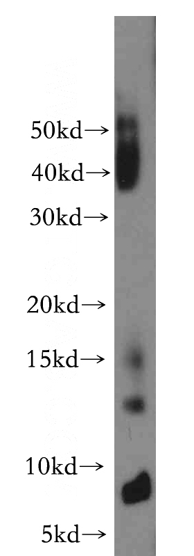 A549 cells were subjected to SDS PAGE followed by western blot with Catalog No:114045(POLR2J antibody) at dilution of 1:800