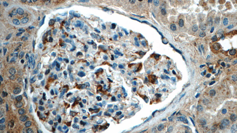Immunohistochemistry of paraffin-embedded human kidney tissue slide using Catalog No:115450(SNCAIP Antibody) at dilution of 1:50 (under 40x lens)