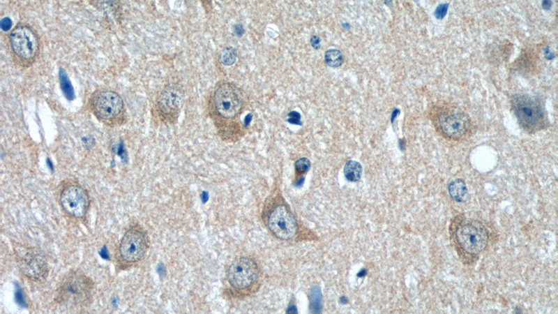 Immunohistochemistry of paraffin-embedded mouse brain tissue slide using Catalog No:113257(NMUR1 Antibody) at dilution of 1:50 (under 40x lens)