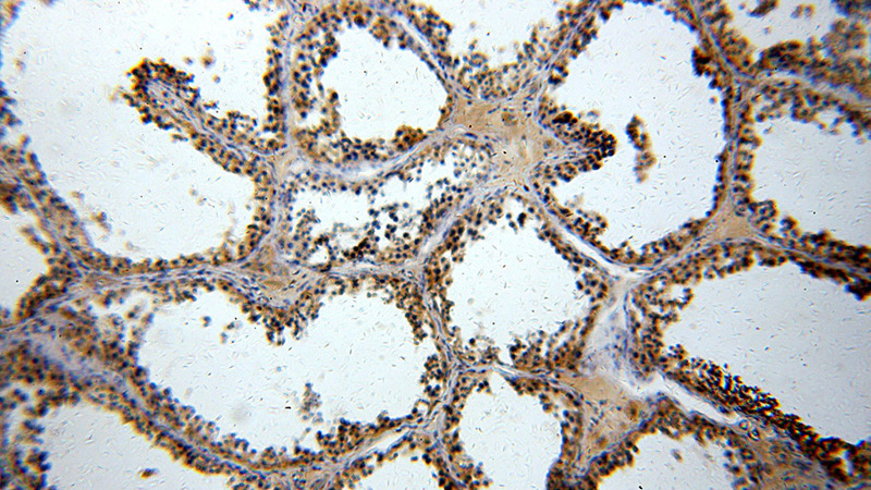 Immunohistochemical of paraffin-embedded human testis using Catalog No:114871(RUNDC3A antibody) at dilution of 1:100 (under 10x lens)