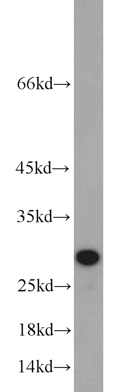 mouse spleen tissue were subjected to SDS PAGE followed by western blot with Catalog No:109056(CD151 antibody) at dilution of 1:300