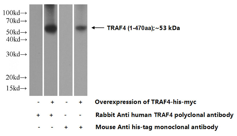 Transfected HEK-293 cells were subjected to SDS PAGE followed by western blot with Catalog No:116232(TRAF4 Antibody) at dilution of 1:2000