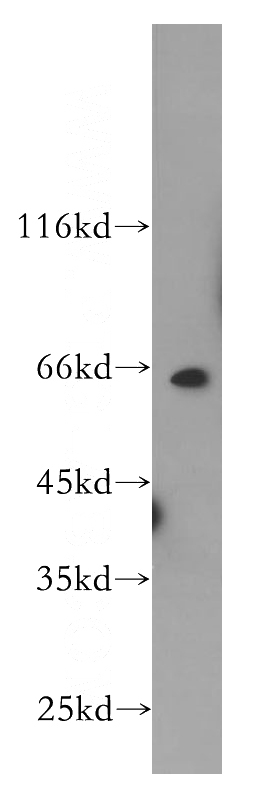 HeLa cells were subjected to SDS PAGE followed by western blot with Catalog No:114170(PRCC antibody) at dilution of 1:500