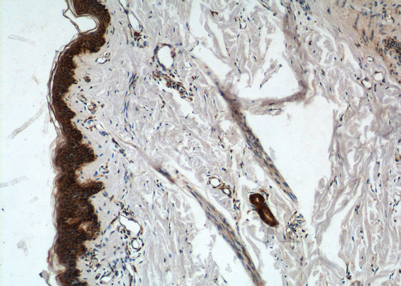 Immunohistochemistry of paraffin-embedded human skin tissue slide using Catalog No:107694(ACSF2 Antibody) at dilution of 1:50 (under 10x lens)