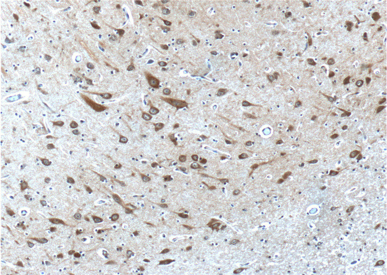 Immunohistochemistry of paraffin-embedded human brain tissue slide using Catalog No:114268(PTGER3 Antibody) at dilution of 1:200 (under 10x lens)