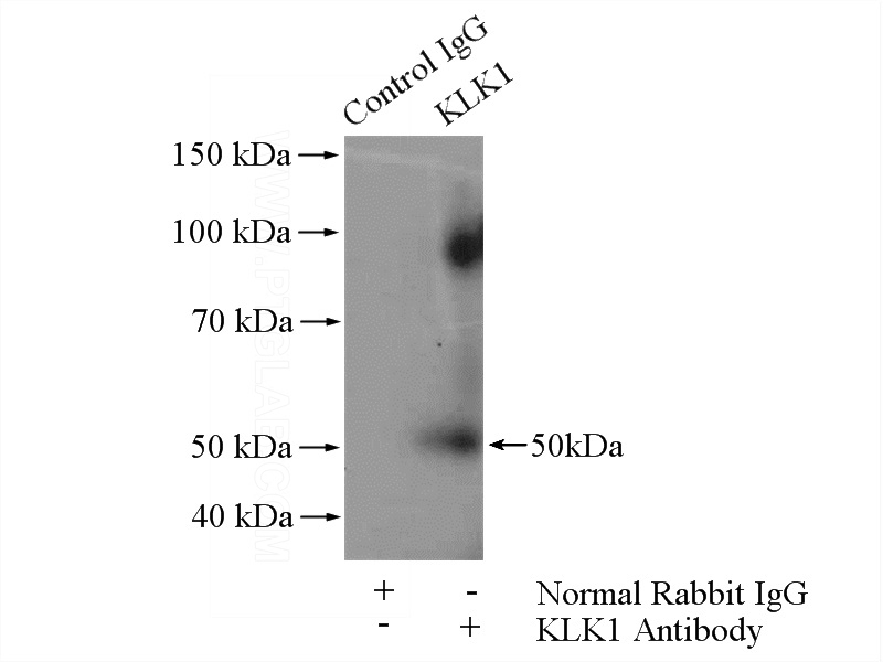 IP Result of anti-KLK1 (IP:Catalog No:111901, 4ug; Detection:Catalog No:111901 1:500) with BxPC-3 cells lysate 1520ug.