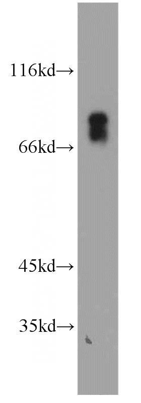 human stomach tissue were subjected to SDS PAGE followed by western blot with Catalog No:116800(VSIG1 antibody) at dilution of 1:1500