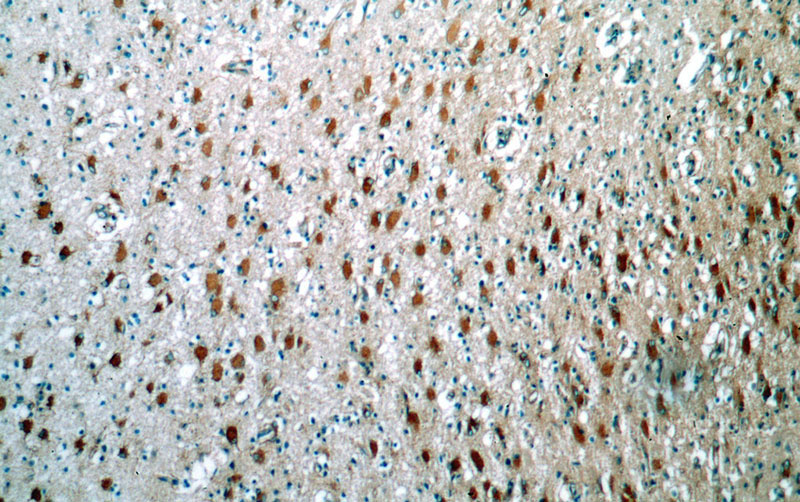 Immunohistochemical of paraffin-embedded human brain using Catalog No:116834(WNT2 antibody) at dilution of 1:100 (under 10x lens)