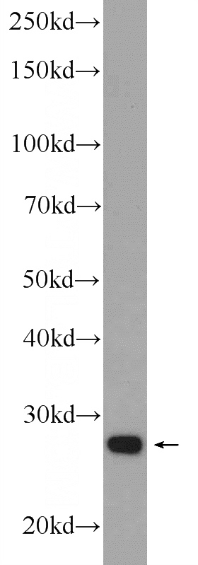 Raji cells were subjected to SDS PAGE followed by western blot with Catalog No:116453(TXNDC9 Antibody) at dilution of 1:1000