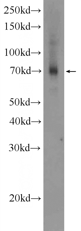 human placenta tissue were subjected to SDS PAGE followed by western blot with Catalog No:110610(FDXACB1 Antibody) at dilution of 1:1000