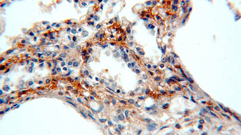 Immunohistochemical of paraffin-embedded human lung using Catalog No:111348(C11orf73 antibody) at dilution of 1:100 (under 40x lens)