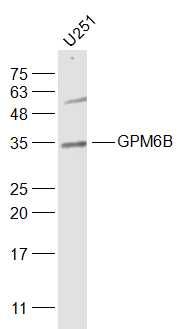 Fig1: Sample:; U251(Human) Cell Lysate at 30 ug; Primary: Anti-GPM6B at 1/1000 dilution; Secondary: IRDye800CW Goat Anti-Rabbit IgG at 1/20000 dilution; Predicted band size: 29 kD; Observed band size: 34 kD