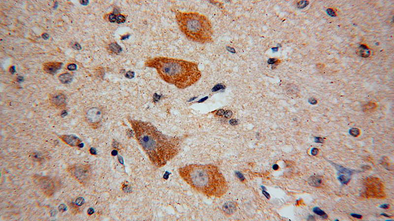 Immunohistochemical of paraffin-embedded human brain using Catalog No:113072(NDUFB2 antibody) at dilution of 1:100 (under 40x lens)