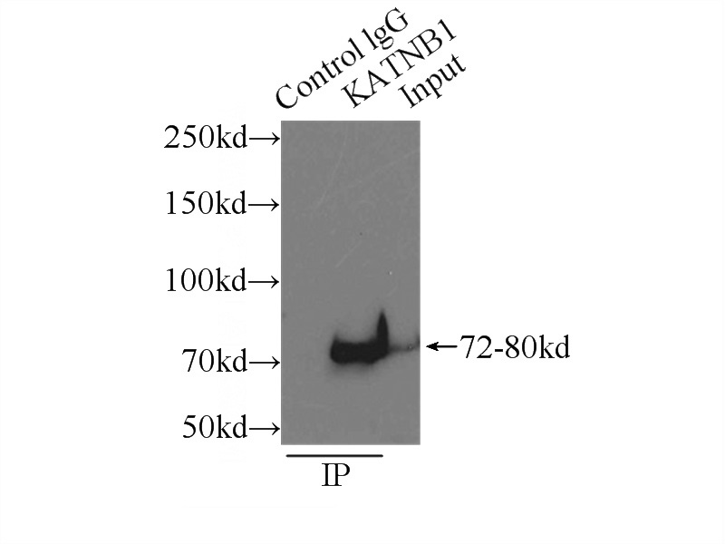 IP Result of anti-KATNB1 (IP:Catalog No:111916, 3ug; Detection:Catalog No:111916 1:500) with HeLa cells lysate 3000ug.