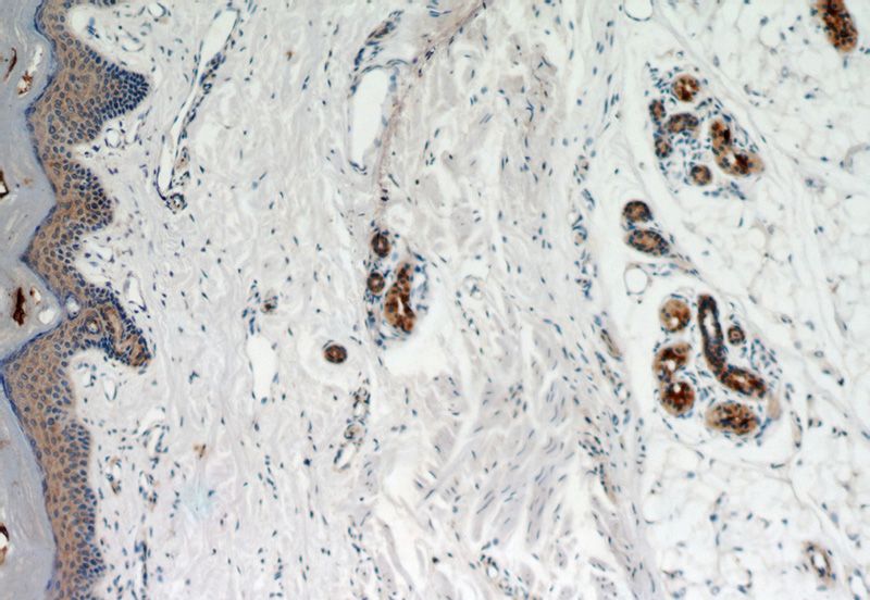 Immunohistochemical of paraffin-embedded human skin using Catalog No:114933(RSAD2 antibody) at dilution of 1:50 (under 40x lens)