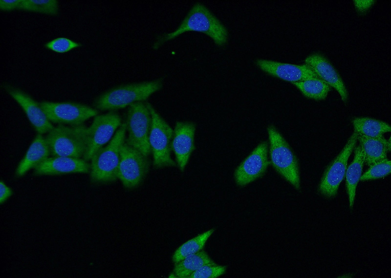 Immunofluorescent analysis of HeLa cells using Catalog No:116626(UPF3A Antibody) at dilution of 1:50 and Alexa Fluor 488-congugated AffiniPure Goat Anti-Rabbit IgG(H+L)