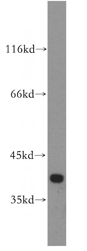HeLa cells were subjected to SDS PAGE followed by western blot with Catalog No:110463(FAM118B antibody) at dilution of 1:500
