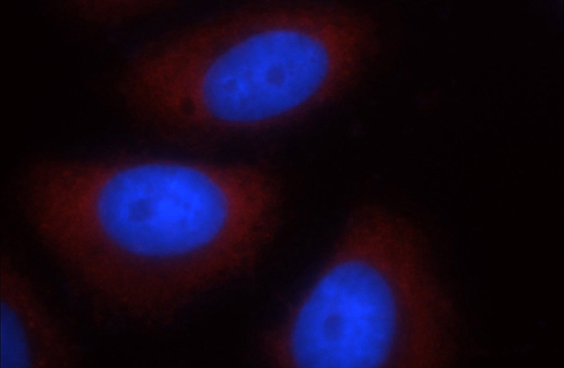 Immunofluorescent analysis of HepG2 cells using Catalog No:110732(FMR1 Antibody) at dilution of 1:25 and Rhodamine-Goat anti-Rabbit IgG