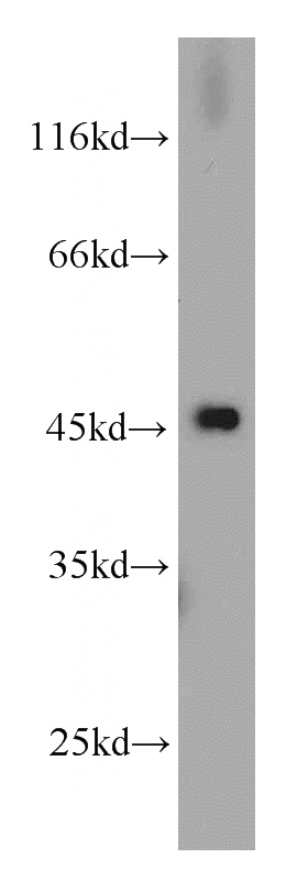 mouse placenta tissue were subjected to SDS PAGE followed by western blot with Catalog No:114887(RPL3 antibody) at dilution of 1:1000