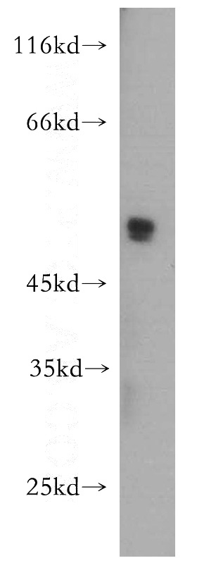 MCF7 cells were subjected to SDS PAGE followed by western blot with Catalog No:109012(CD24 antibody) at dilution of 1:500