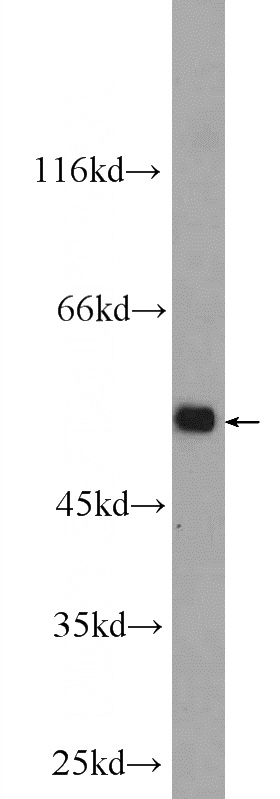mouse liver tissue were subjected to SDS PAGE followed by western blot with Catalog No:114211(PRoc Antibody) at dilution of 1:1000